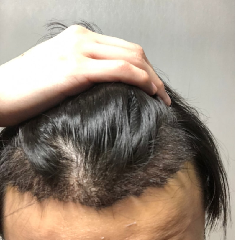 99335953-D5C0-4251-BC00-6F748F890093.png