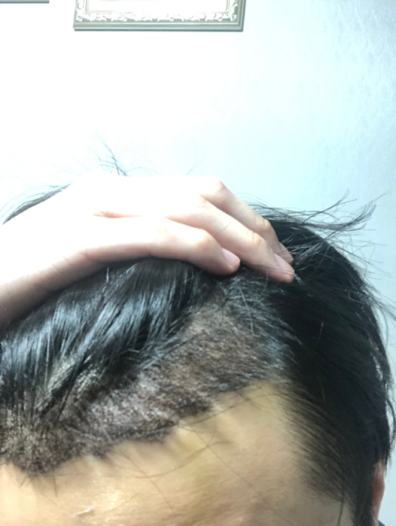 875094B1-C8C2-488C-BCAB-EC3F045CB271.png