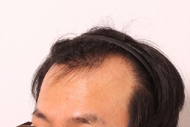 전.PNG