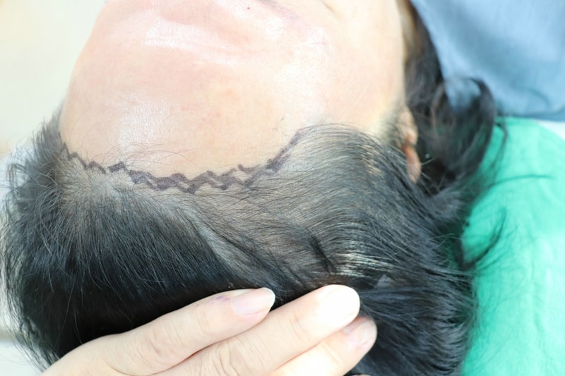 수술전 6.jpg