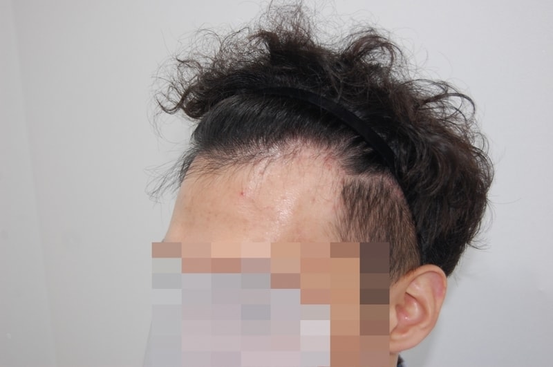 전 좌측.jpg