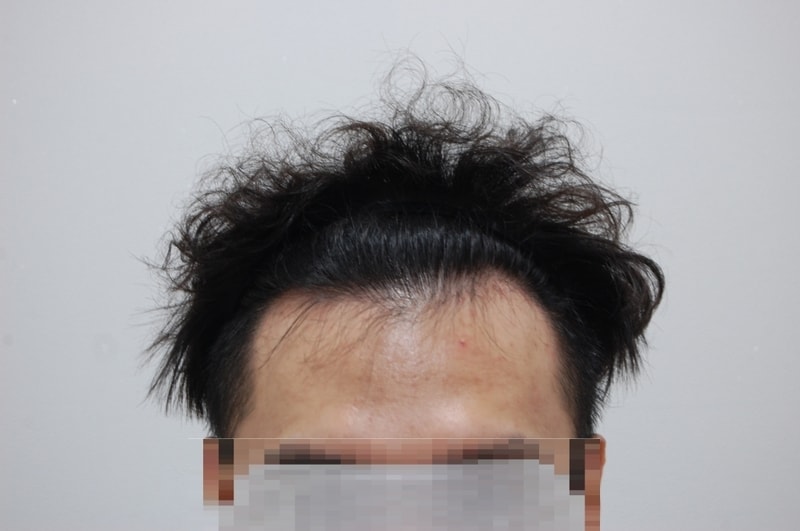 전 정면.jpg
