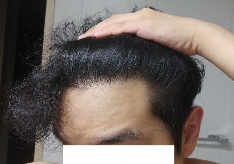 좌측 앞.jpg