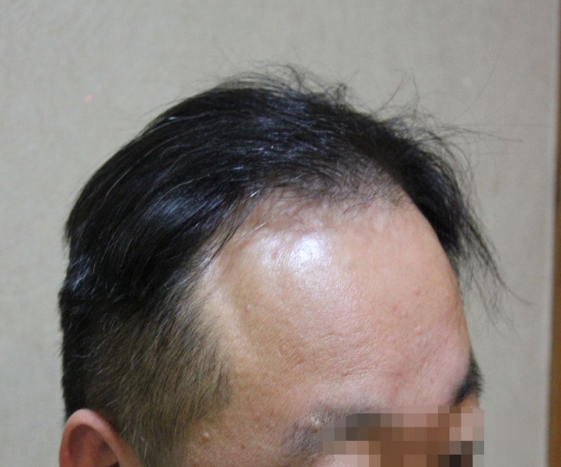 JP 대량5000천모 1년 8개월 지난 후기 남깁니다 -두번째 후기-
