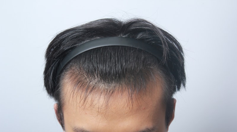 수술전 5.jpg
