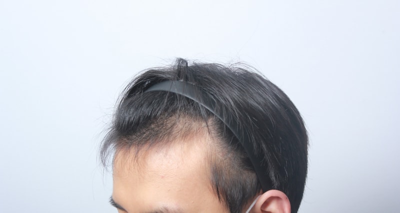 수술전 13.jpg