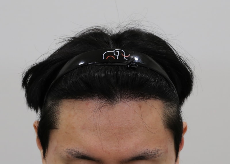 10개월 경과.jpg