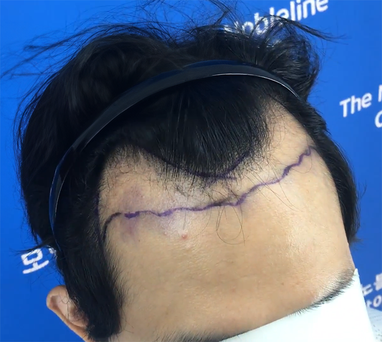 It's been 11 days since the operation of Director Baek Hyun-wook of Novelline.