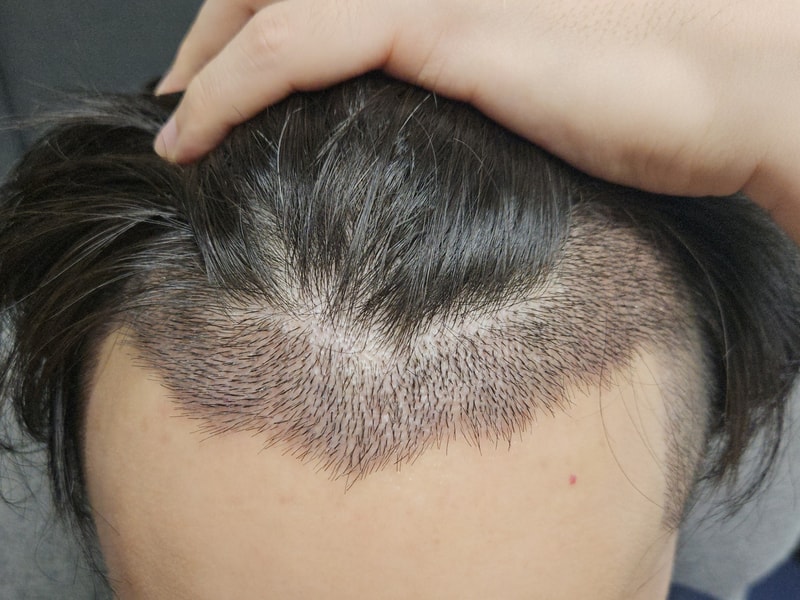 I planted my hair after seeing Da Da Mo.