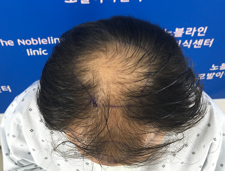 8개월 쾌거 입니다!