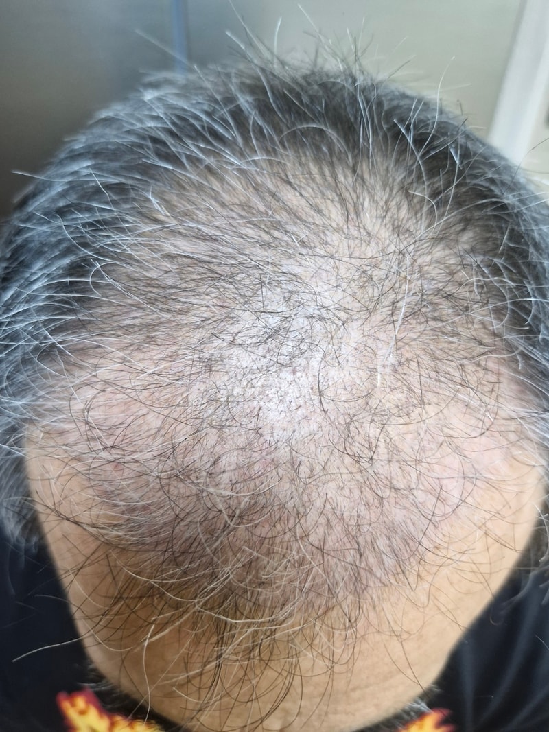 92일째 입니다.