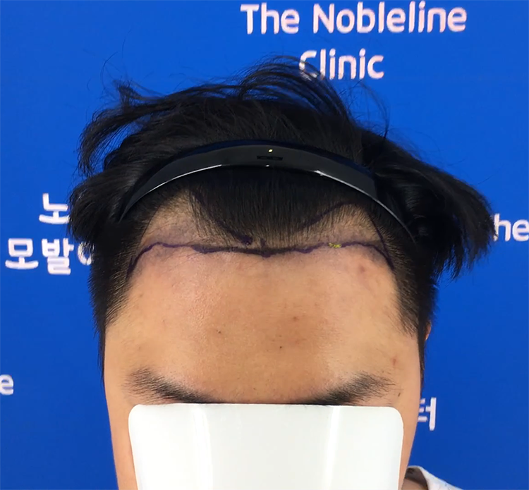 7개월째 속단하긴 이르지만 성공쪽으로 달려가고 있는 것 같습니다.