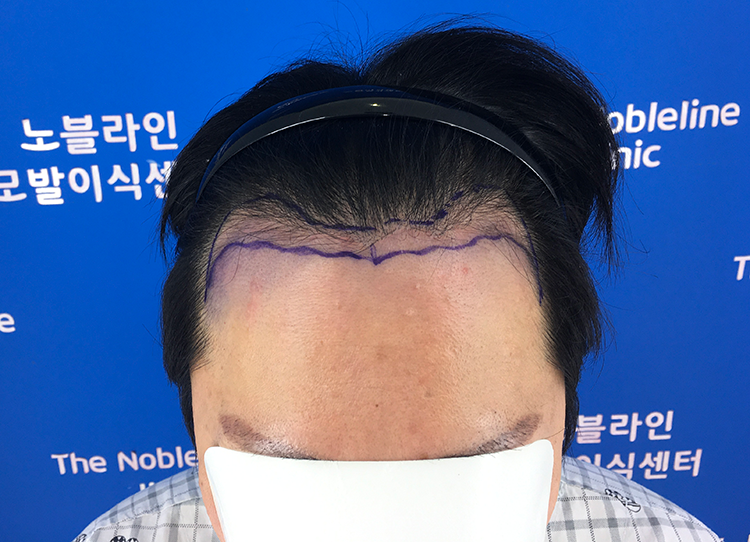 3개월 암흑기 지나고 있네요.