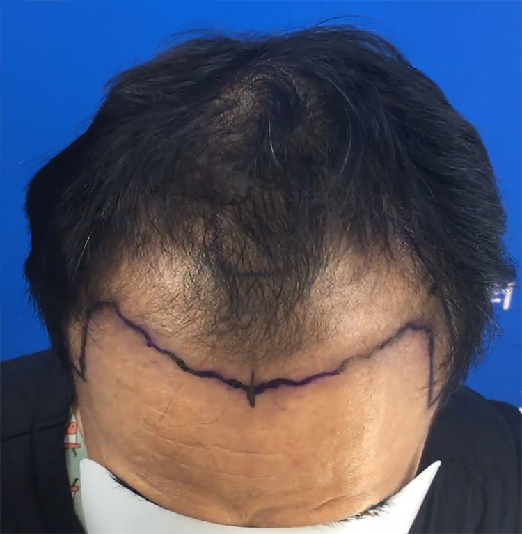 16개월, 졸업 후 사진 정직하게 찍어서 올려봅니다.
