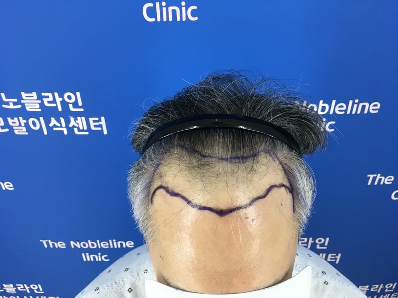 I got surgery from Director Baek, who is full of energy. (6286 mother-of-one)