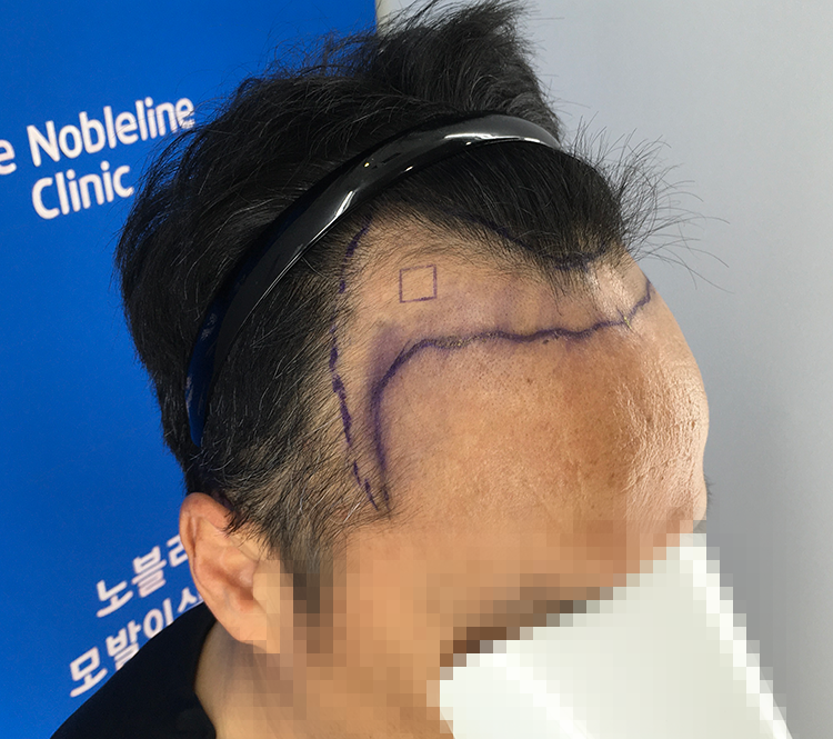 4개월차, 하루가 다르게 머리가 자라고 있네요.