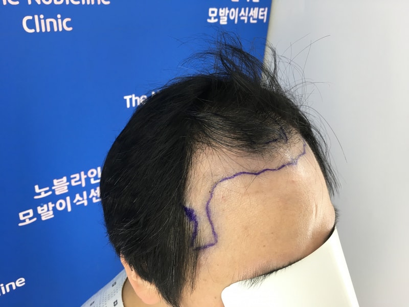 칠흑 같은 암흑기 지나 서광이 보이는 160일차 후기.