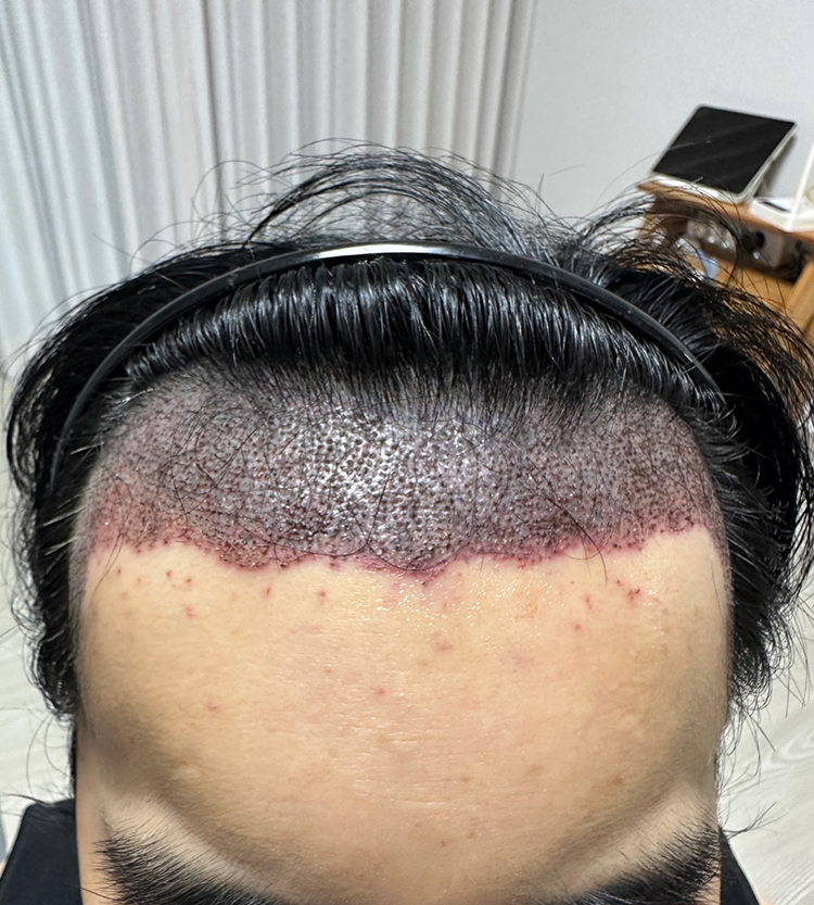 190일차 6개월 경과 공유