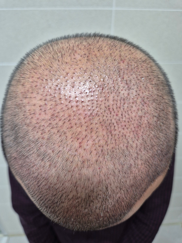 KakaoTalk_20241127_164159163_03.png
