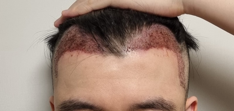 2일.jpg