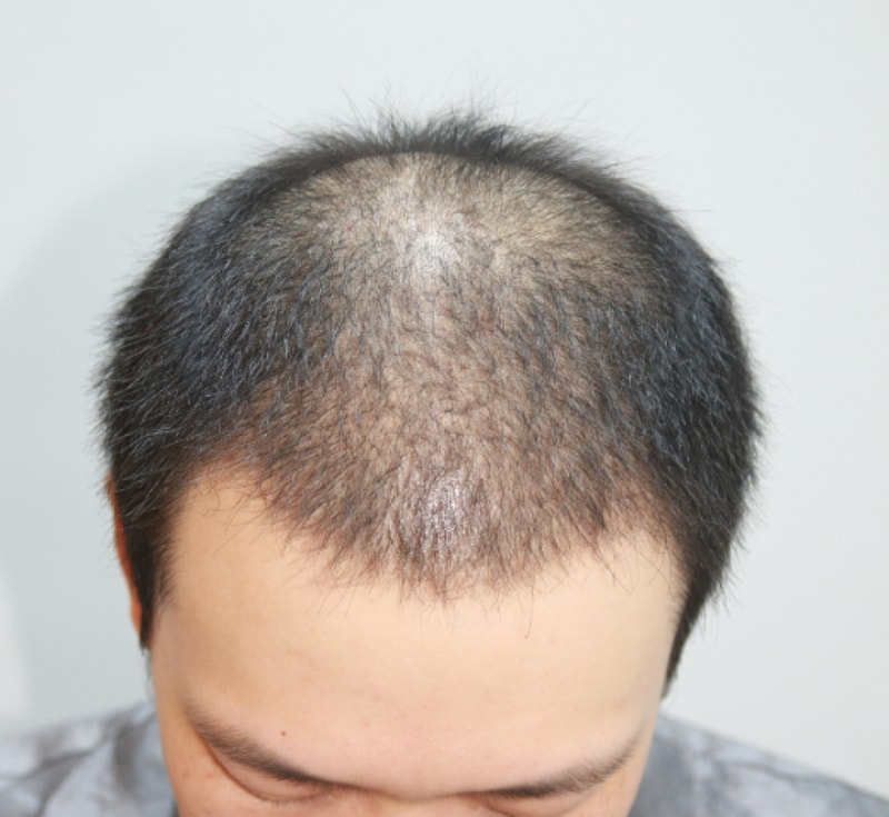 20150302_212906.png