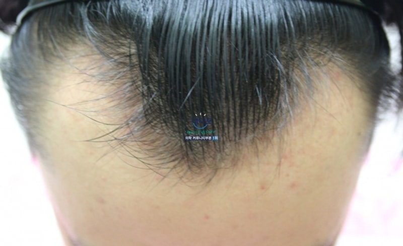 bb5563aa848f710462ee499701303887.jpg
