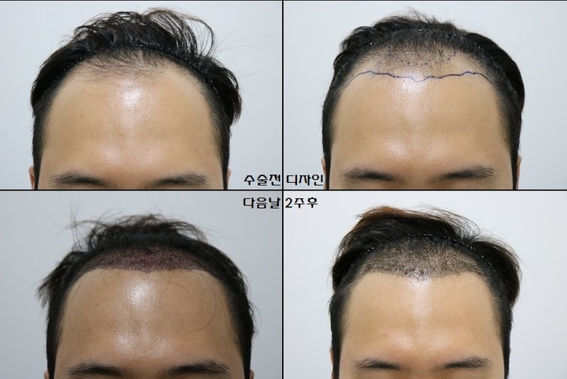 1년 농사 끝났습니다