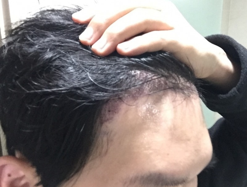 KakaoTalk_20160225_152103098.jpg