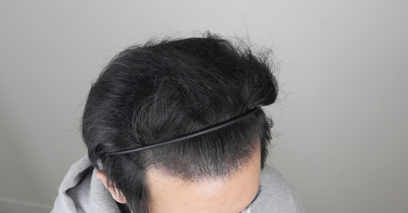 윗면 후.jpg