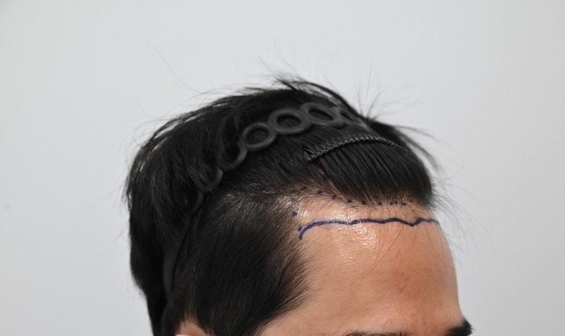 1000007892.jpg
