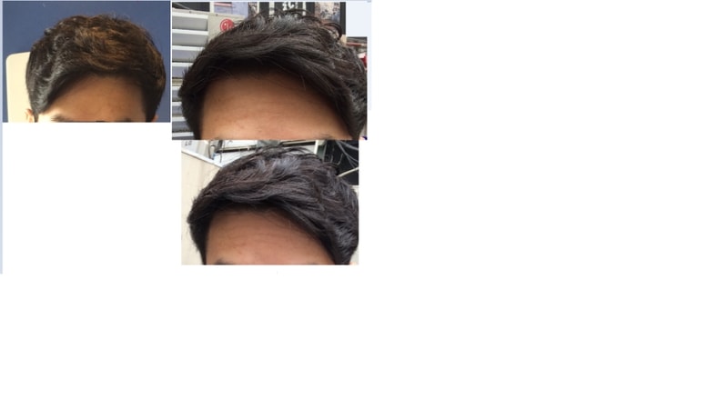 셋팅 후.png