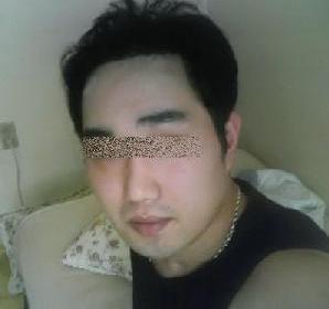 이식.jpg
