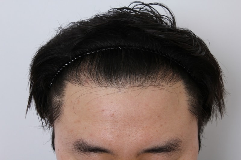 12개월 M.JPG