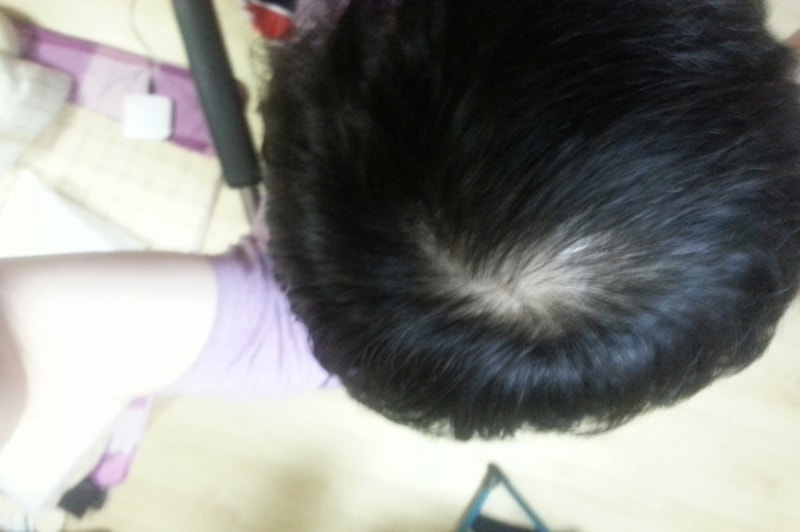 12개월 정수리.jpg
