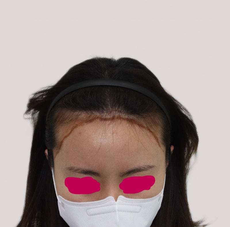 수술전.JPG