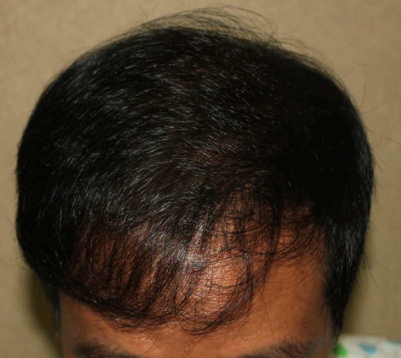 수술후 (1).JPG