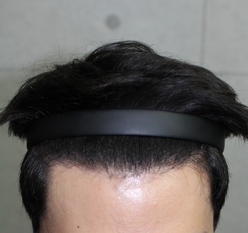6개월째 m자 라인.png