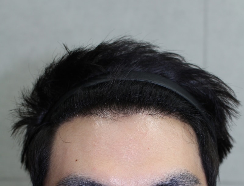 6개월째 완전 정면.png