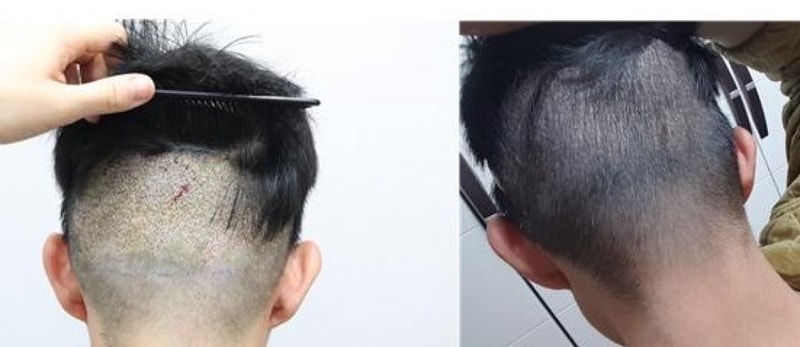 10일차 통수001.jpg