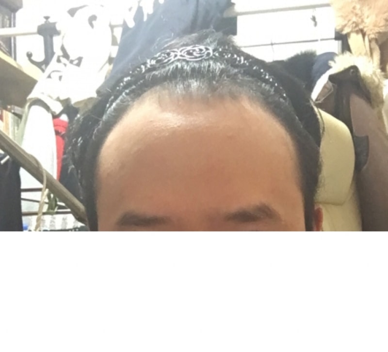 수술전 셀카.png