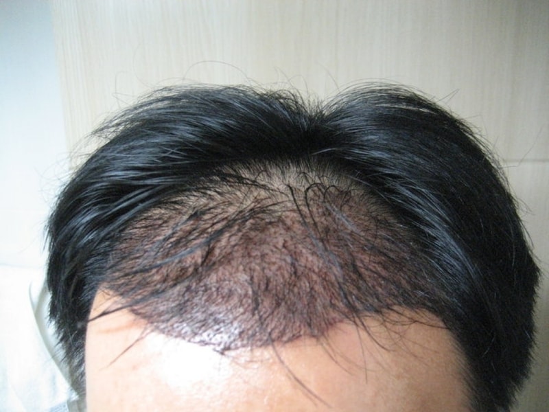 수술2일째.jpg
