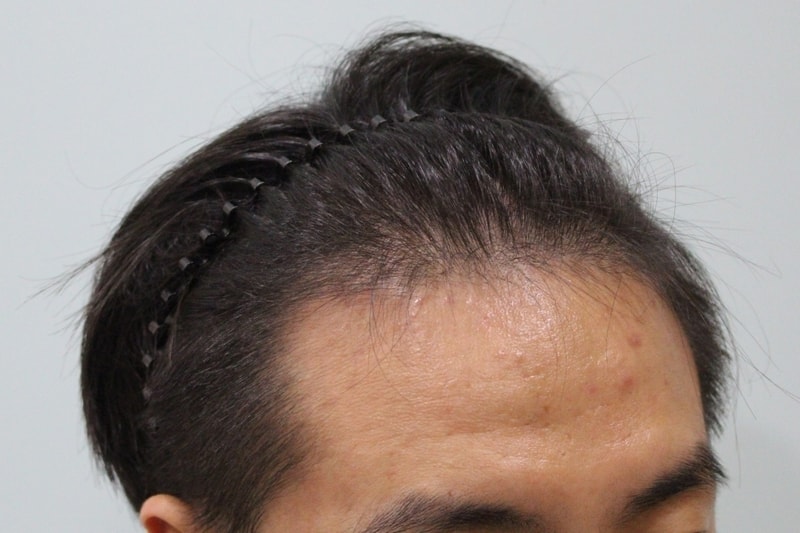 수술전 (11).JPG