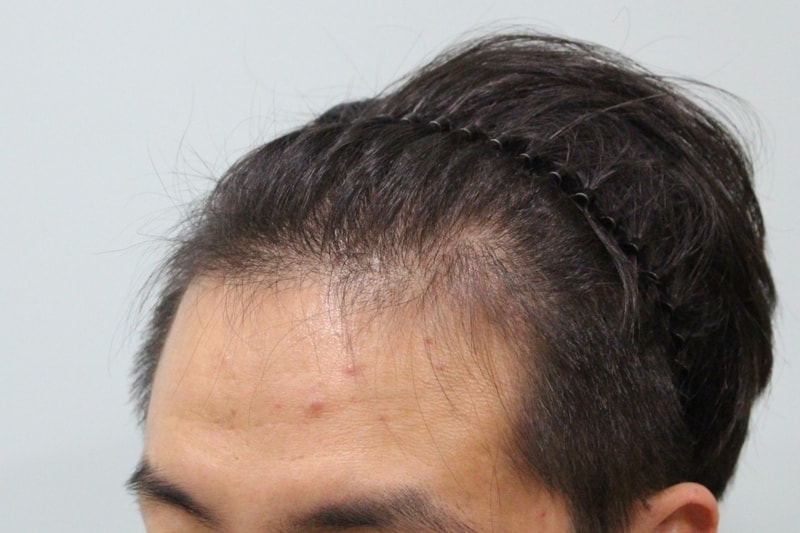 수술전 (10).JPG