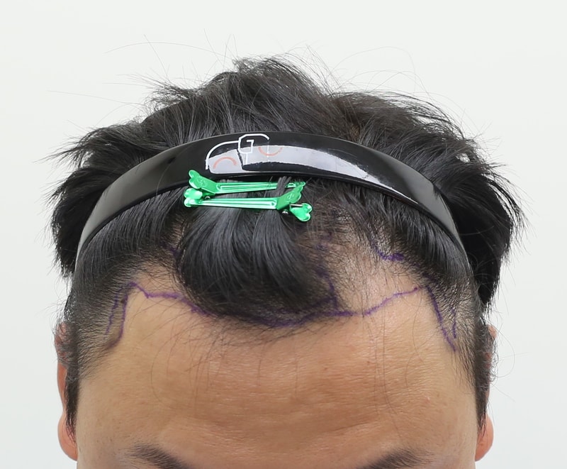 1000053846.jpg