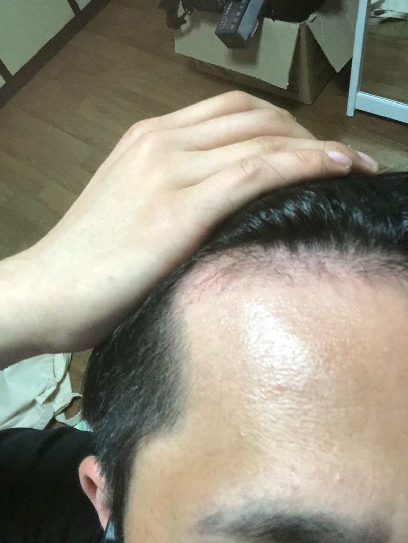 오른쪽.jpg