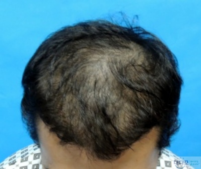 before.jpg