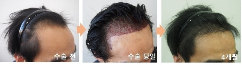 우측.jpg