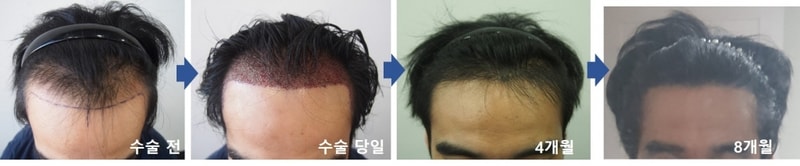 정면9.jpg