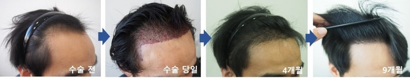 우측9.jpg