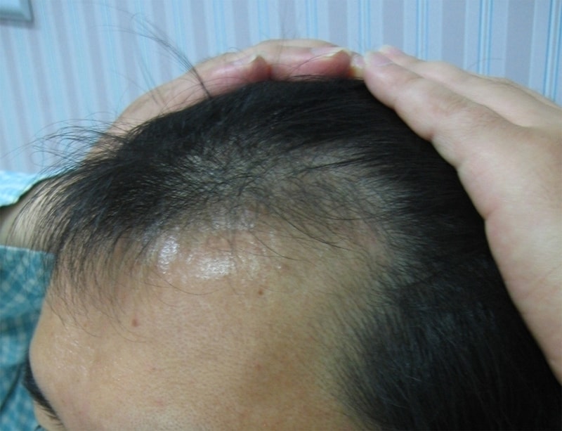 수술전1.jpg